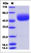 SDS-PAGE - Recombinant Mouse CD160 protein (Fc Chimera) (AB276930), expandable thumbnail