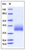 SDS-PAGE - Recombinant Mouse CD161 protein (His tag) (AB276931)