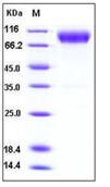 SDS-PAGE - Recombinant mouse CD200R protein (Fc Chimera His Tag) (AB276795), expandable thumbnail