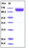 SDS-PAGE - Recombinant mouse CD200R protein (Fc Chimera His Tag) (AB276795)