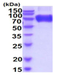 SDS-PAGE - Recombinant mouse CD200R protein (His tag) (AB219227)