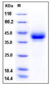 SDS-PAGE - Recombinant Mouse CD209B/DC-SIGNR1 protein (His tag) (AB276856)