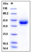 SDS-PAGE - Recombinant Mouse CD209B/DC-SIGNR1 protein (His tag) (AB276856)