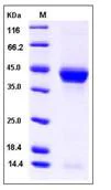 SDS-PAGE - Recombinant Mouse CD23 protein (His tag) (AB276905)