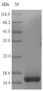SDS-PAGE - Recombinant Mouse CD3 epsilon protein (His tag) (AB240841), expandable thumbnail