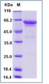 SDS-PAGE - Recombinant Mouse CD300 protein (Fc Chimera) (AB277022)