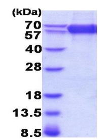 SDS-PAGE - Recombinant Mouse CD36 protein (AB208474), expandable thumbnail