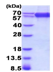 SDS-PAGE - Recombinant Mouse CD36 protein (His tag C-Terminus) (AB208474)