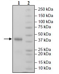 Recombinant Mouse CD38 protein (Tagged)
