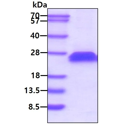SDS-PAGE - Recombinant Mouse CD40 protein (His tag) (AB208459)