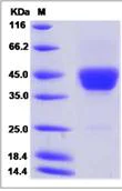 SDS-PAGE - Recombinant Mouse CD52 protein (Fc Chimera) (AB276913)