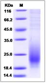 SDS-PAGE - Recombinant Mouse CD53 protein (His tag) (AB276914), expandable thumbnail