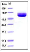 SDS-PAGE - Recombinant Mouse CD5L/CT-2 protein (His tag) (AB276747)