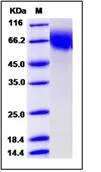 SDS-PAGE - Recombinant Mouse CD6/T12 protein (His tag) (AB276911)
