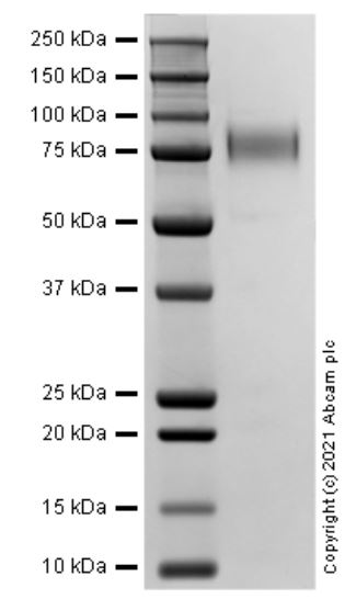 SDS-PAGE - Recombinant Mouse CD62E protein (AB283464)