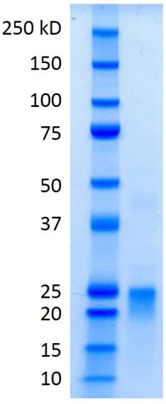 SDS-PAGE - Recombinant Mouse CD62L protein (AB205901)