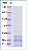 SDS-PAGE - Recombinant Mouse CD63 protein (AB276872)