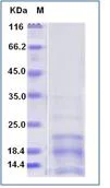 SDS-PAGE - Recombinant Mouse CD63 protein (AB276872)