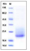 SDS-PAGE - Recombinant Mouse CD7 protein (His tag) (AB276834)
