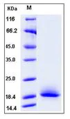 SDS-PAGE - Recombinant Mouse CD72 protein (His tag) (AB276915)