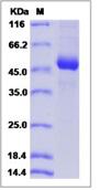 SDS-PAGE - Recombinant Mouse CD79a protein (Fc Chimera) (AB276918), expandable thumbnail