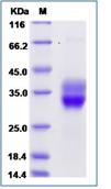 SDS-PAGE - Recombinant Mouse CD8 alpha + CD8B protein (Tagged) (AB277035), expandable thumbnail