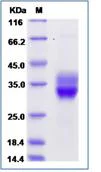 SDS-PAGE - Recombinant Mouse CD8 alpha + CD8B protein (Tagged) (AB277035)