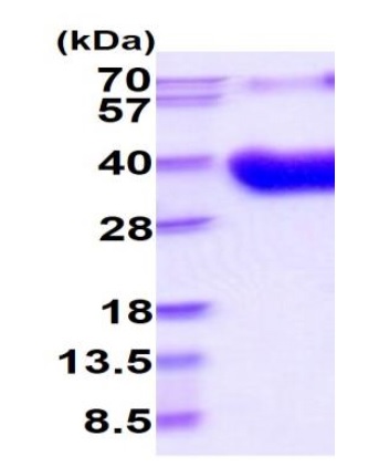 SDS-PAGE - Recombinant Mouse CD80 protein (His tag) (AB222422), expandable thumbnail