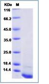 SDS-PAGE - Recombinant Mouse CD81 protein (His tag) (AB276921), expandable thumbnail