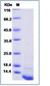 SDS-PAGE - Recombinant Mouse CD81 protein (His tag) (AB276921)