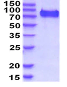 SDS-PAGE - Recombinant Mouse CD93 protein (His tag C-Terminus) (AB208464)