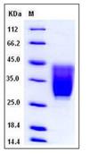 SDS-PAGE - Recombinant Mouse CD99L2 protein (His tag) (AB276864), expandable thumbnail