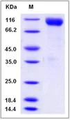 SDS-PAGE - Recombinant Mouse CDCP1 protein (His tag) (AB276981)