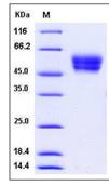 SDS-PAGE - Recombinant Mouse Cell adhesion molecule 4 protein (His tag) (AB276862), expandable thumbnail