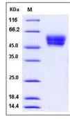SDS-PAGE - Recombinant Mouse Cell adhesion molecule 4 protein (His tag) (AB276862)