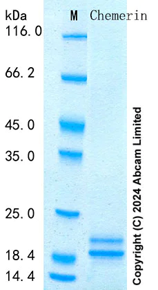 SDS-PAGE - Recombinant Mouse Chemerin Protein Standard (His tag) (AB316623)