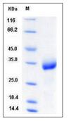 SDS-PAGE - Recombinant Mouse CHODL protein (His tag) (AB276906), expandable thumbnail