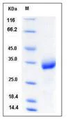 SDS-PAGE - Recombinant Mouse CHODL protein (His tag) (AB276906)