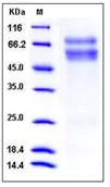 SDS-PAGE - Recombinant Mouse CHST3 protein (His tag) (AB276879)