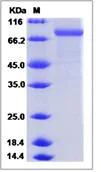 SDS-PAGE - Recombinant Mouse CHST5 protein (Fc Chimera) (AB276996)