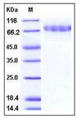 SDS-PAGE - Recombinant Mouse CLEC14A protein (His tag) (AB276808), expandable thumbnail