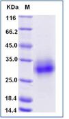 SDS-PAGE - Recombinant Mouse CLEC4A protein (His tag) (AB276945), expandable thumbnail