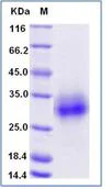 SDS-PAGE - Recombinant Mouse CLEC4A protein (His tag) (AB276945)