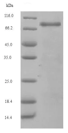 SDS-PAGE - Recombinant Mouse Complement factor B protein (His tag) (AB226229)