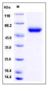 SDS-PAGE - Recombinant Mouse CPM protein (His tag) (AB276958)