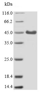 SDS-PAGE - Recombinant Mouse CR1L protein (His tag) (AB238362)