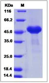 SDS-PAGE - Recombinant Mouse CRELD1 protein (His tag) (AB276992)