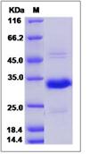 SDS-PAGE - Recombinant Mouse CRISP1 protein (His tag) (AB276995)
