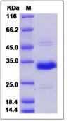 SDS-PAGE - Recombinant Mouse CRISP1 protein (His tag) (AB276995)