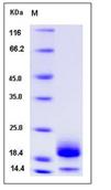 SDS-PAGE - Recombinant Mouse CST6 protein (His tag) (AB276937), expandable thumbnail